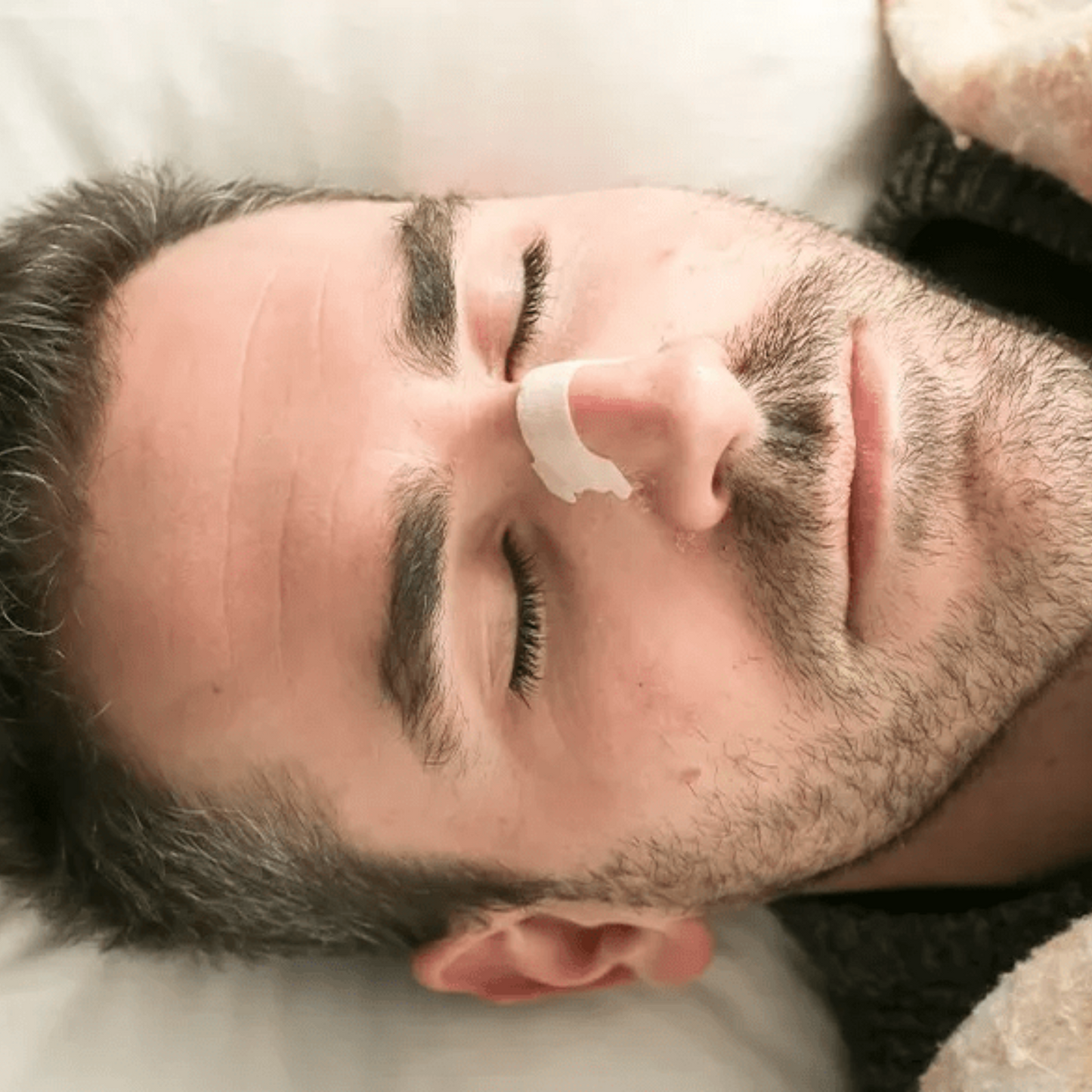 Nasal Strips (100 Pack)