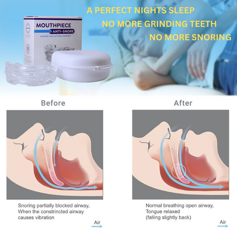 Anti-Snore Mouthpiece